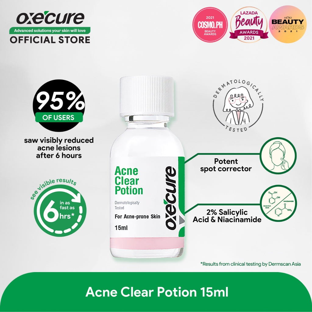 Acne on sale clear potion