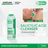 Acne Clear Facial Cleanser