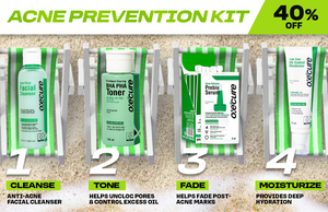 Acne Prevention Kit