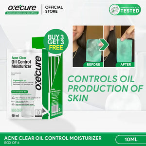 Acne Clear Oil Control Moisturizer 10ml [Buy 3, Get 3 FREE]