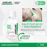 Acne Clear Potion