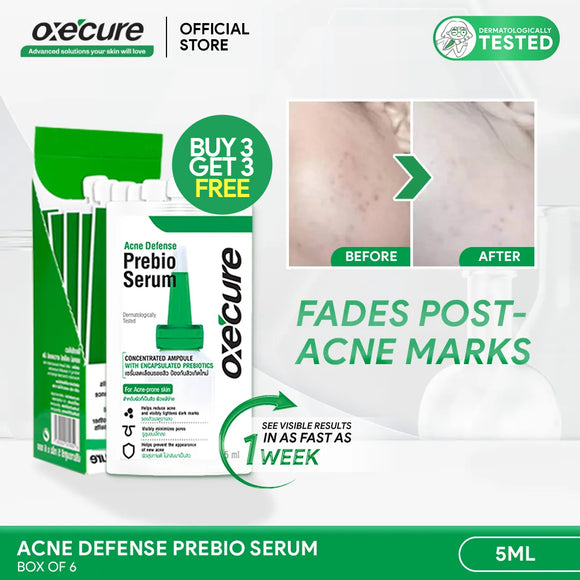 Acne Defense Prebio Serum 5ml [Buy 3, Get 3 FREE]