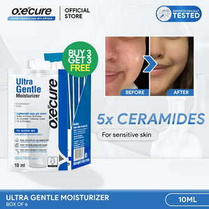 Ultra Gentle Moisturizer 10ml [Buy 3, Get 3 FREE]