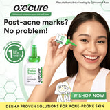 Acne Defense Prebio Serum
