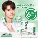 Acne-Fighting Duo